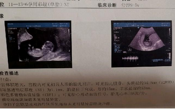 12周nt宝宝特点