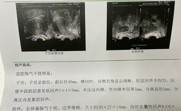 促排卵怀孕和自然怀孕有区别吗